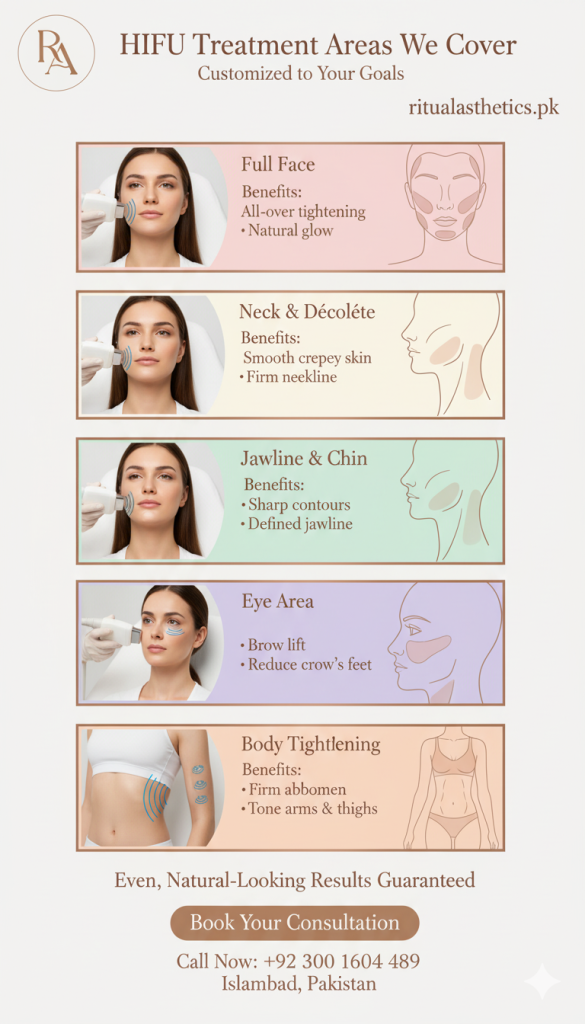 hifu treatment areas
