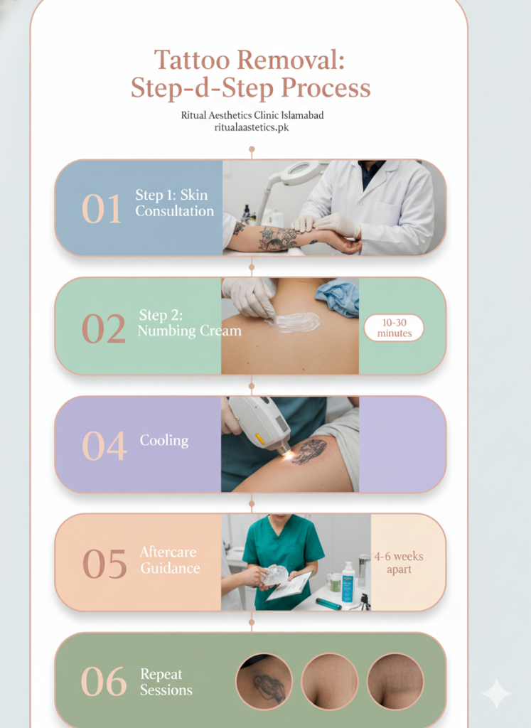 laser-tato-removal-islamabad