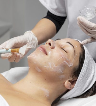Chemical Peel