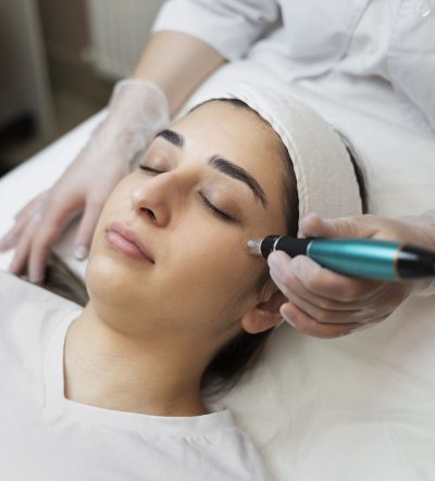 Microneedling Dermapen