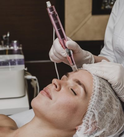 Microneedling Radio Frequency